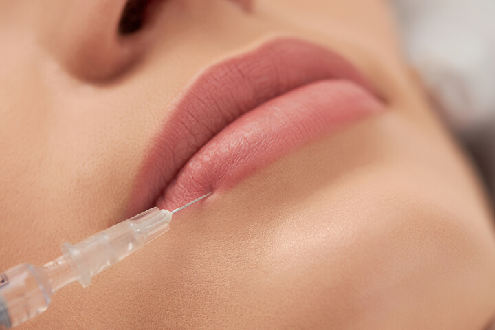 woman receiving lip filler injection 